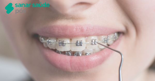 Especialistas em odontologia e suas vantagens na carreira