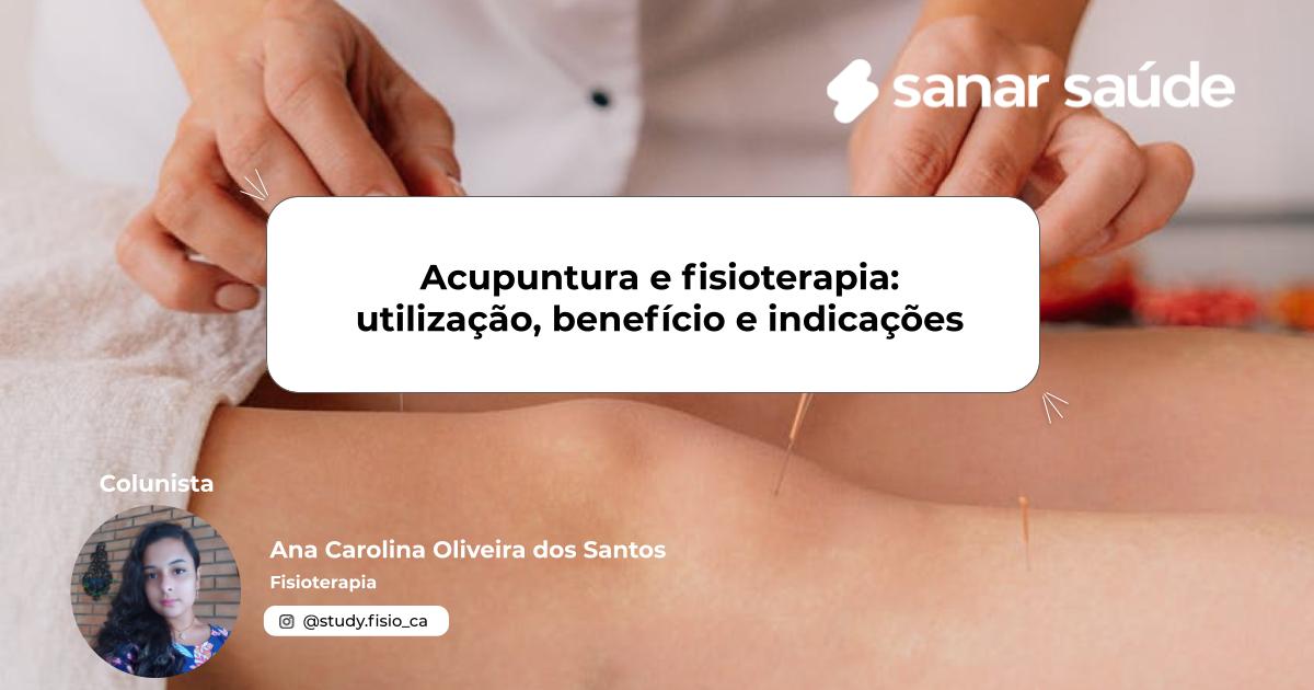 Acupuntura e fisioterapia: utilização, benefício e indicações | Colunista